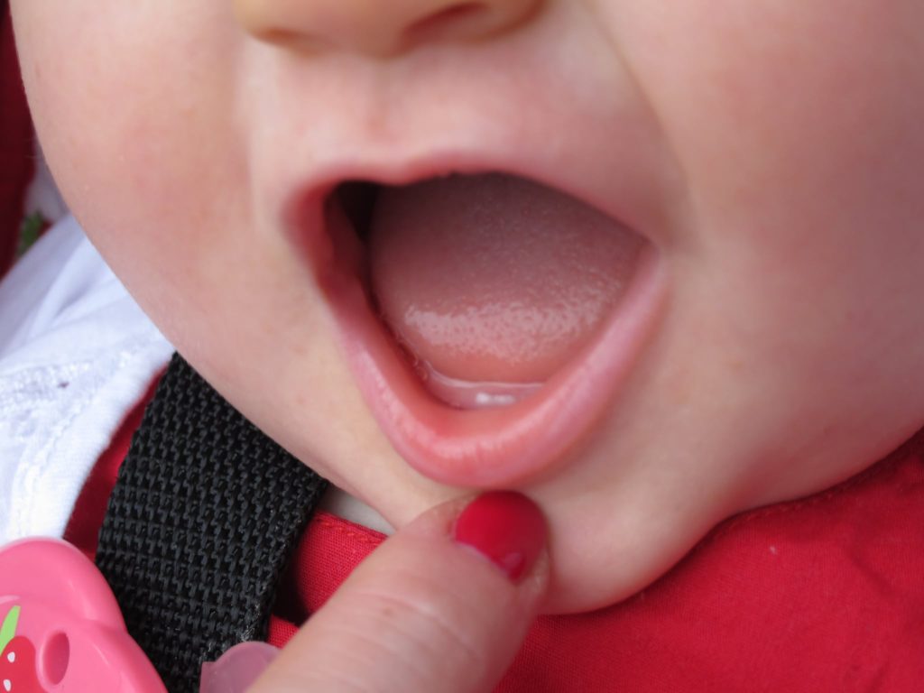 teeth development